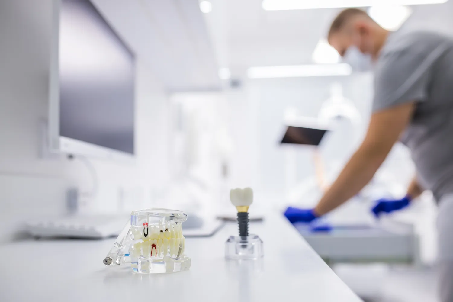 Implanty co to jest?