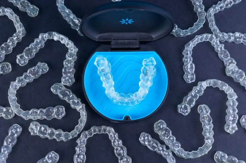 Jak długo trwa leczenie Invisalign?