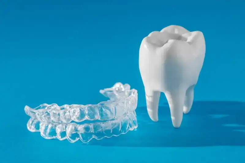 Aparat Invisalign