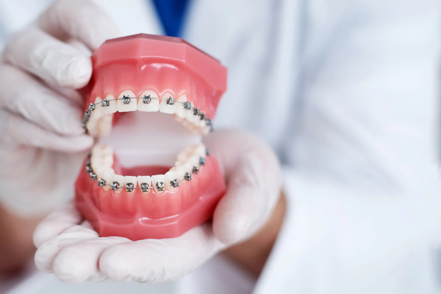 Ranking implantów zębowych - o tym warto wiedzieć