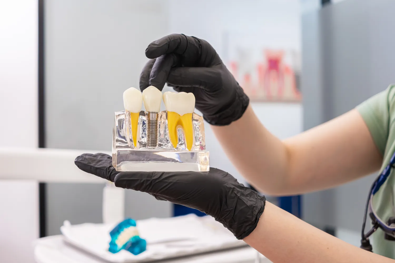 Rodzaje implantów zębowych